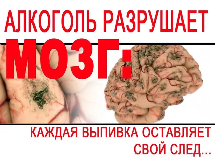 plakat-Alcohol_Razrushaet_Mozg